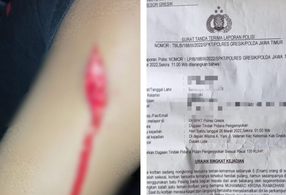 Hendak Pulang Usai Nongkrong, Pemuda Berkaos Logo Perguruan Pencak Silat Di Keroyok Dan Kepalanya Di Hantam Paving Oleh  Sekelompok OTK
