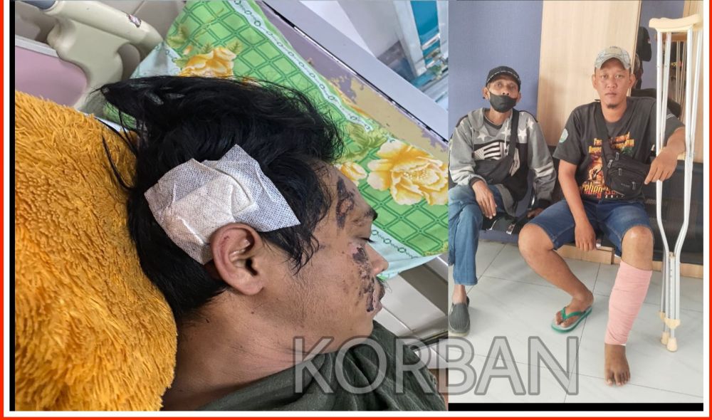 Keterlaluan! 'Delon' Tak Mau Temui Korban Yang Ditabrak