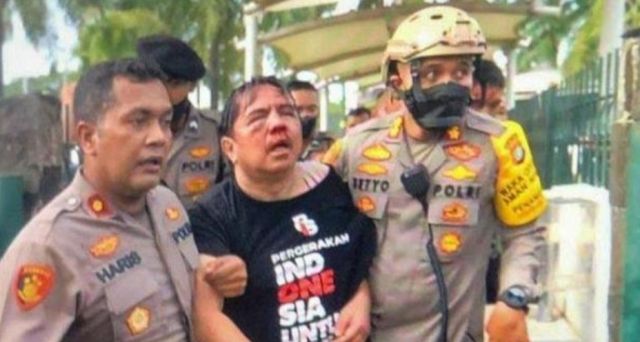 Pegiat Media Sosial Ade Armando, Babak Belur Diduga Digebuki Massa Pendemo